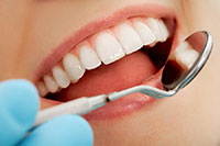 dental mirror examining teeth, Laurel, MS dental cleaning